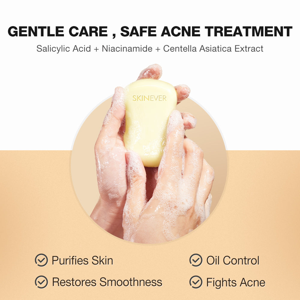 SKINEVER Salicylic Acid Refreshing Acne Soap – Anti-Acne & Oil Control Cleanser UAE