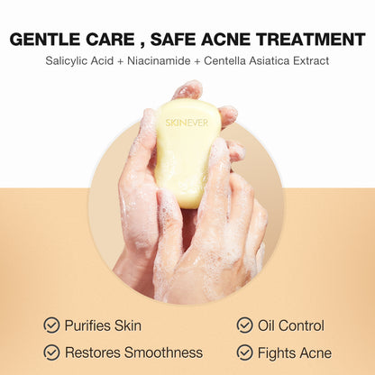 SKINEVER Salicylic Acid Refreshing Acne Soap – Anti-Acne & Oil Control Cleanser UAE