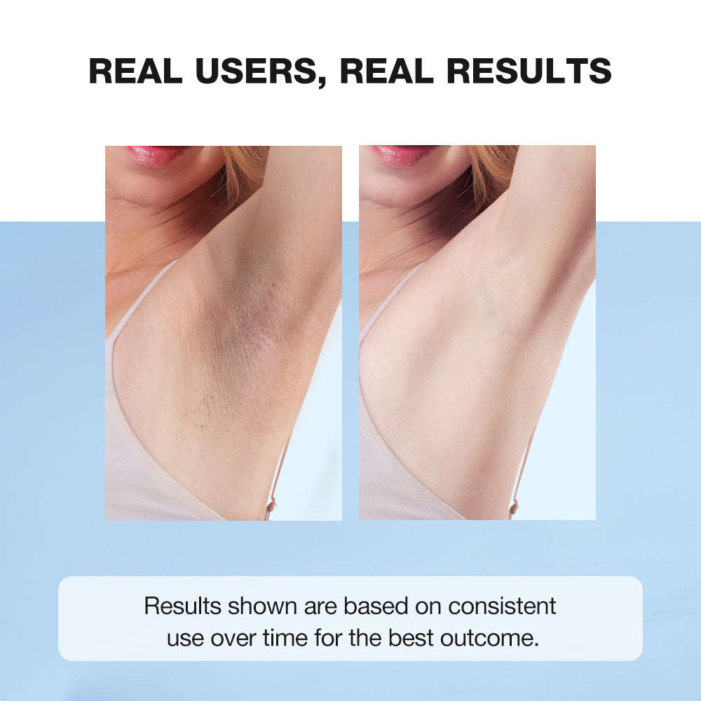 SKINEVER Deodorant Brightening Underarm Cream – Whitening & Odor-Control Cream UAE