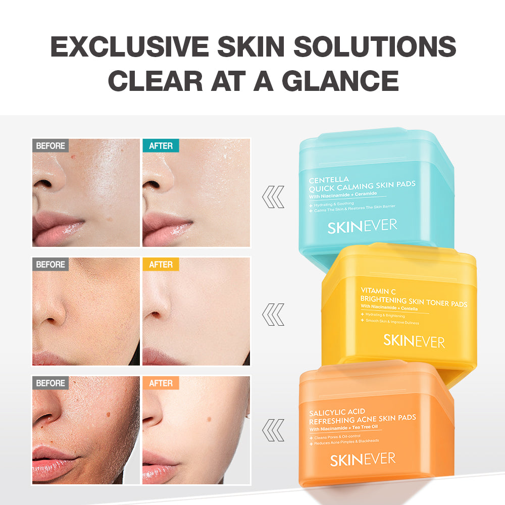 SKINEVER Centella Quick Relief Hydrating Toner Pads – Soothing Cica Toner Pads for Sensitive Skin UAE