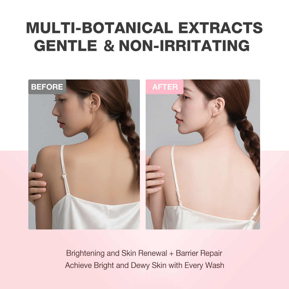 SKINEVER Niacinamide Skin Brightening Cleansing Soap – Whitening & Acne Control Soap UAE