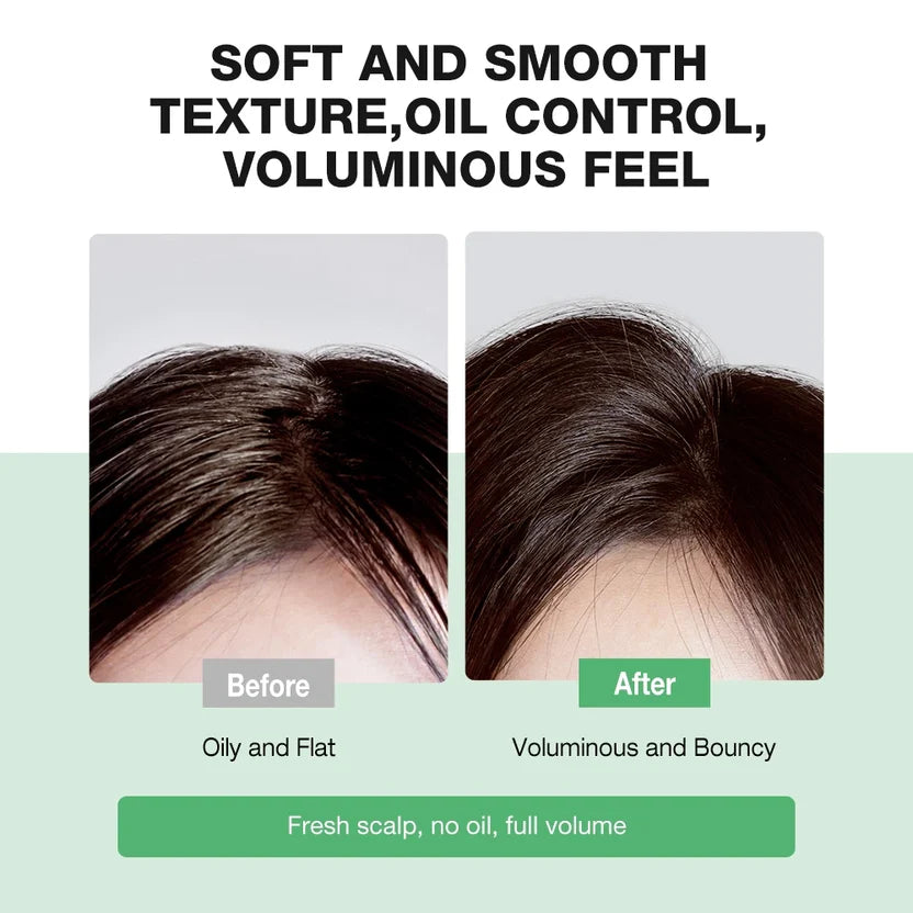 SKINEVER 10X Amino Acid Oil Control Volumizing Shampoo – For Oily Scalp & Fine Hair UAE